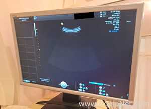 GE Voluson S10 Ultrasound System with Rab6-RS and IC9-RS Transducers